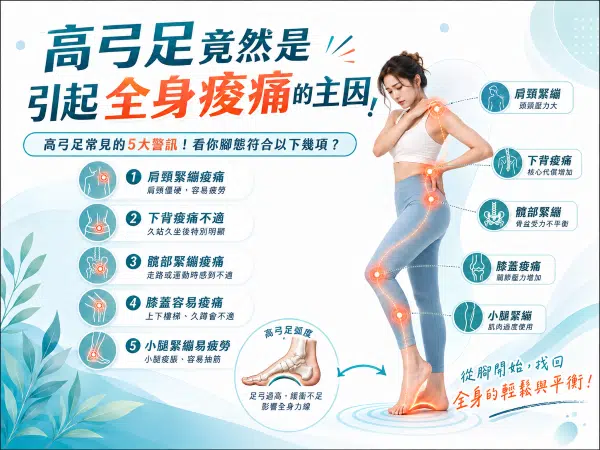 高弓足竟然是引起全身痠痛的主因! 高弓足竟然是引起全身痠痛的主因!