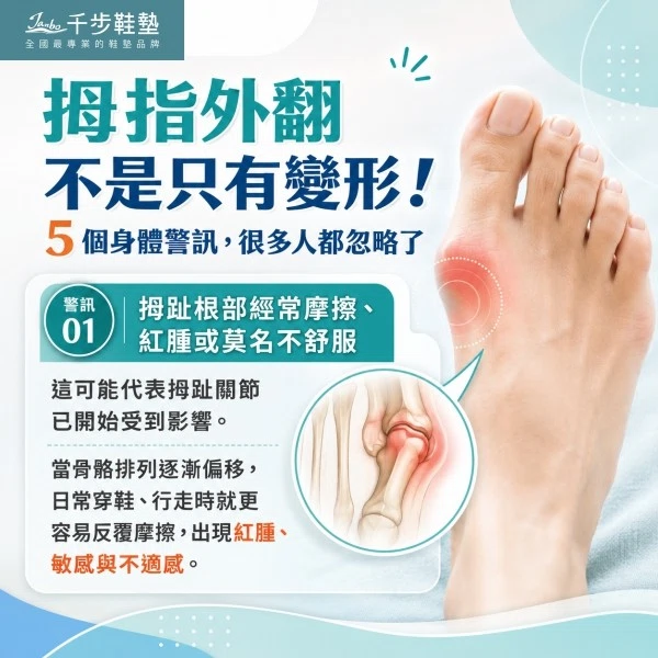 千步鞋墊 | 腰酸背痛不一定是腰的問題 拇指外翻不是只有變形!5 個身體警訊,很多人都忽略了