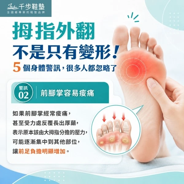 拇指外翻不是只有變形!5 個身體警訊,很多人都忽略了 拇指外翻不是只有變形!5 個身體警訊,很多人都忽略了