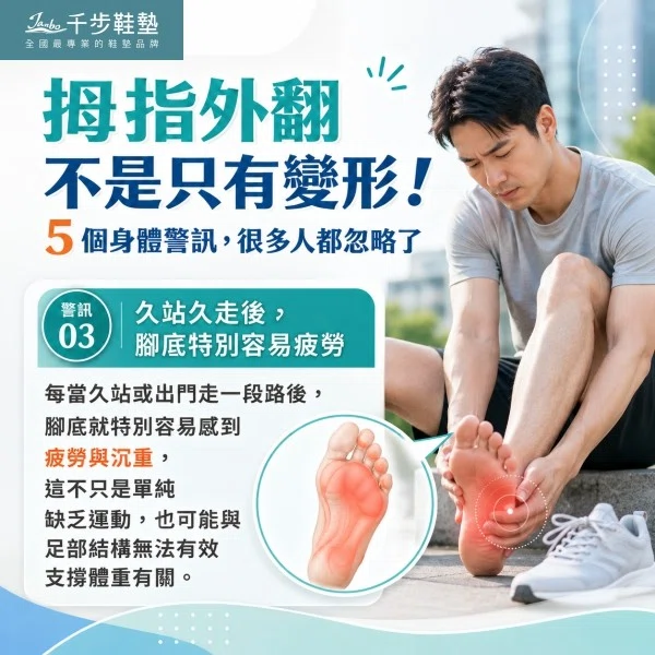 拇指外翻不是只有變形!5 個身體警訊,很多人都忽略了 拇指外翻不是只有變形!5 個身體警訊,很多人都忽略了