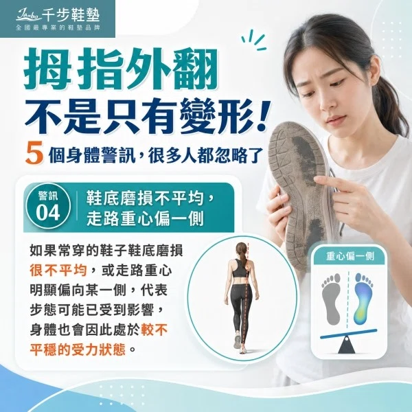 拇指外翻不是只有變形!5 個身體警訊,很多人都忽略了 拇指外翻不是只有變形!5 個身體警訊,很多人都忽略了
