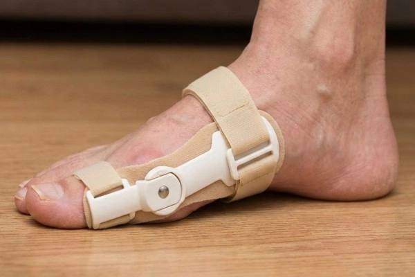 拇指外翻矯正器真的有用嗎？