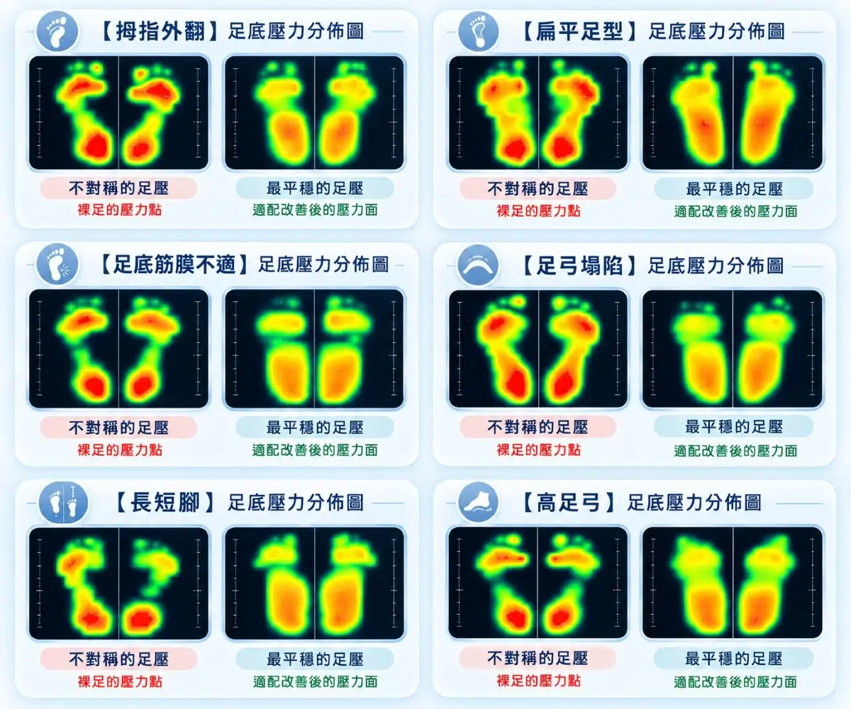 足壓檢測